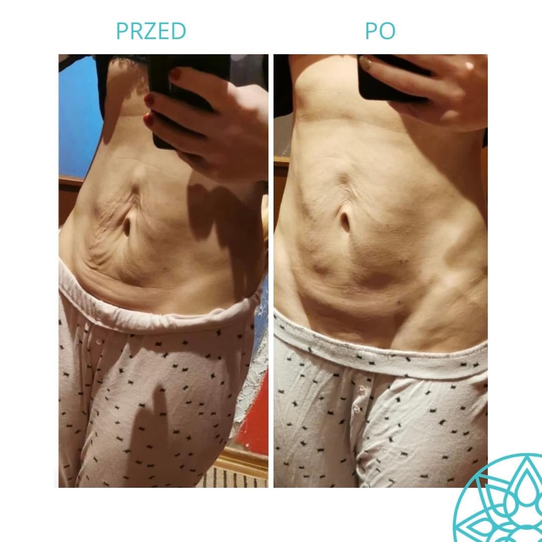 Perfect Look Clinic Środa Wielkopolska · Zdjęcia 3