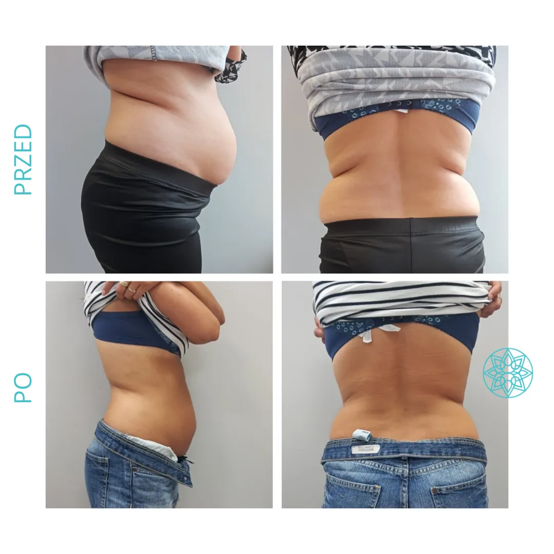 Perfect Look Clinic Środa Wielkopolska · Zdjęcia 4