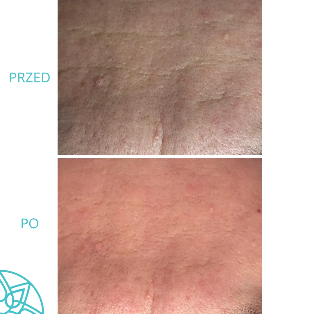 Perfect Look Clinic Środa Wielkopolska · Zdjęcia 6