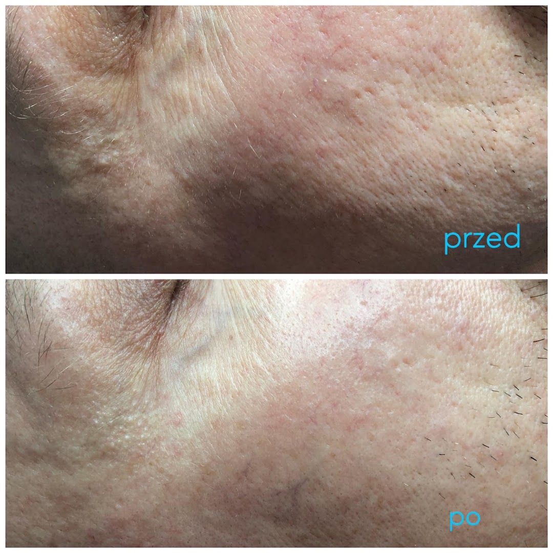 Perfect Look Clinic Środa Wielkopolska · Zdjęcia 5